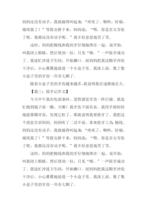 拔牙记作文300字.docx