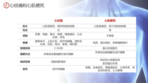 急性心肌梗死术后护理查房PPT教学课件