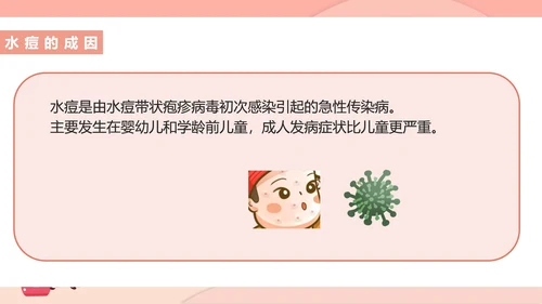 粉色插画风预防水痘医疗教育PPT模板
