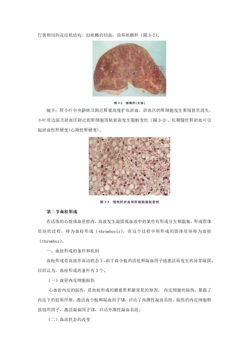 病理学高职02教案03第三章局部血液循环障碍