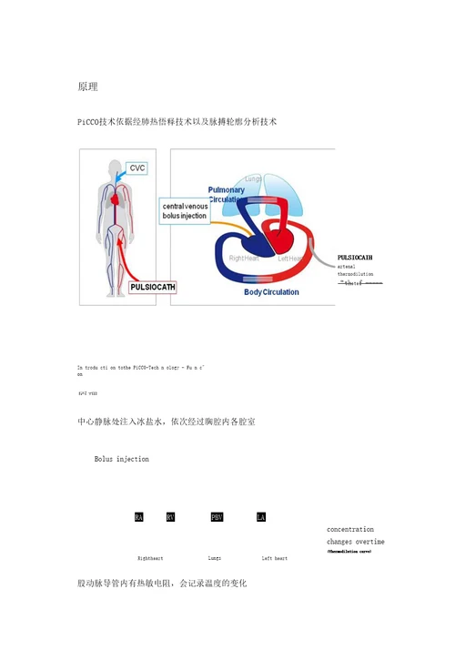 PICCO的临床运用超详细图解版