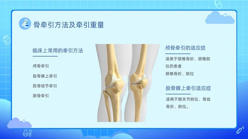 蓝色渐变卡通插画医疗健康骨牵引的护理动态PPT