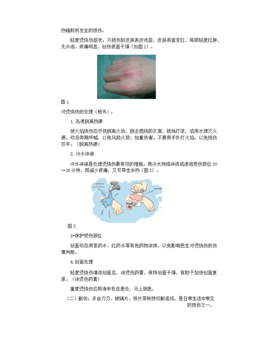 小学体育《轻度损伤的自我处理》教案