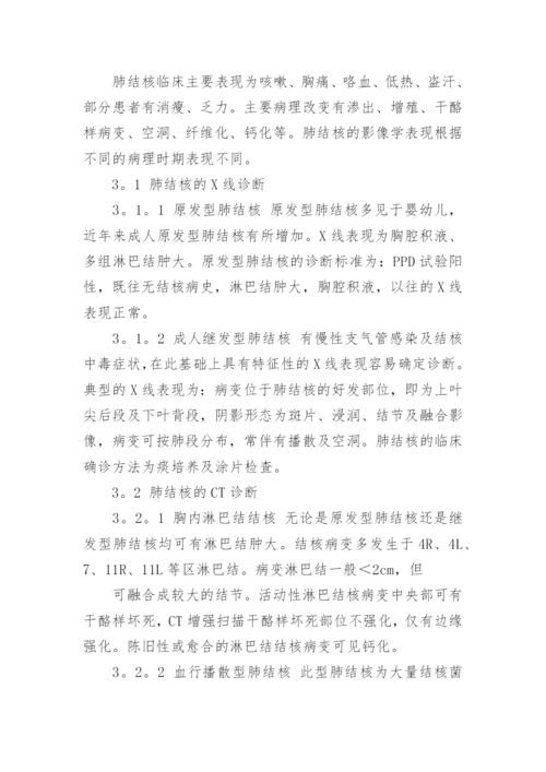 肺结核护理毕业论文.docx