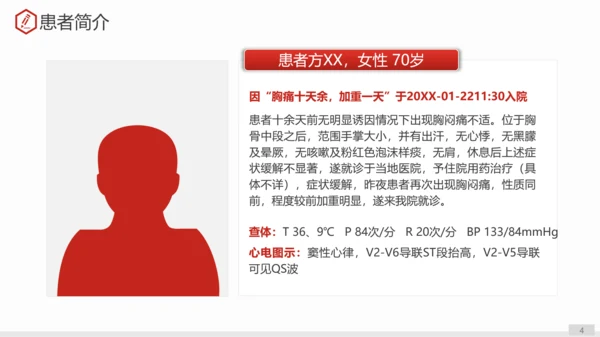 急性心肌梗死术后护理查房PPT教学课件