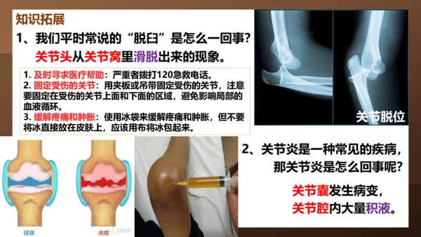 人教版生物八年级上册5.2.1《动物的运动》课件(共27张PPT)+视频素材