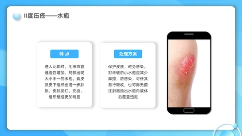 蓝色水彩简约微粒体护理小讲课企业培训PPT护理查房