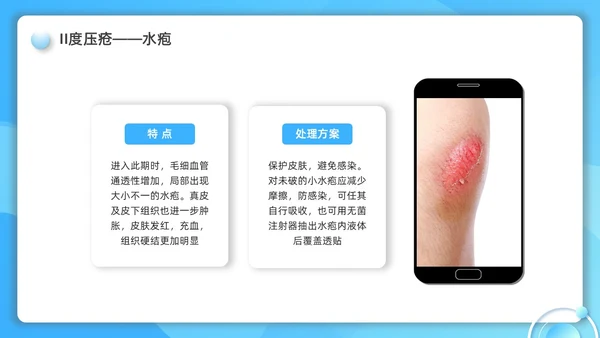 蓝色水彩简约微粒体护理小讲课企业培训PPT护理查房