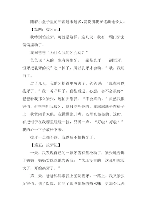 拔牙记作文300字.docx