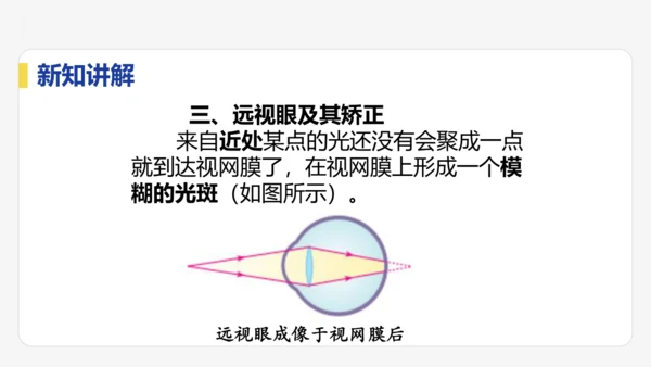5.4  眼睛与眼镜  课件