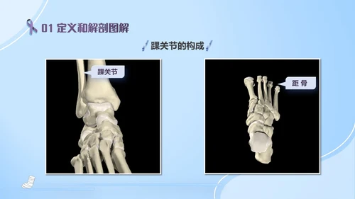 蓝紫色医疗风踝关节骨折护理查房护理PPT模板pptx