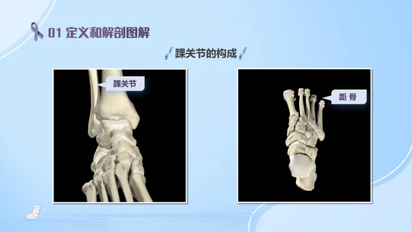 蓝紫色医疗风踝关节骨折护理查房护理PPT模板pptx