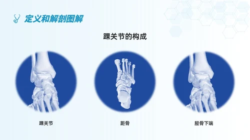 蓝色简约形状踝骨骨折护理查房医护培训ppt
