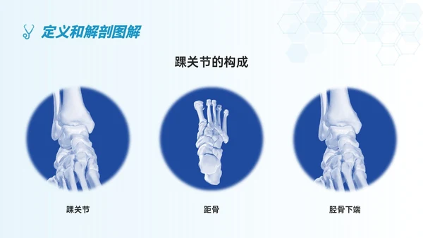 蓝色简约形状踝骨骨折护理查房医护培训ppt