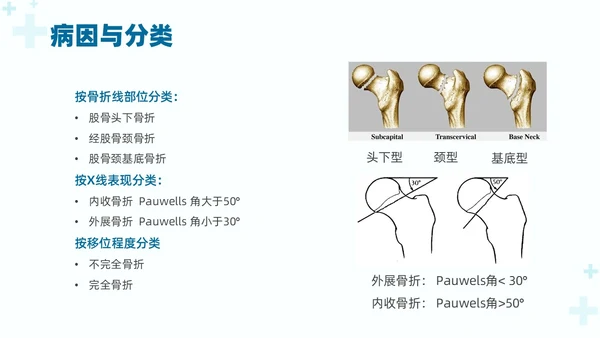 绿色实拍医疗护理培训股骨骨折护理查房培训PPT课件