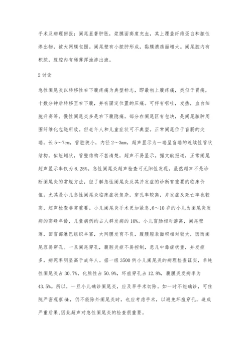 彩超快速诊断小儿急性阑尾炎1例.docx