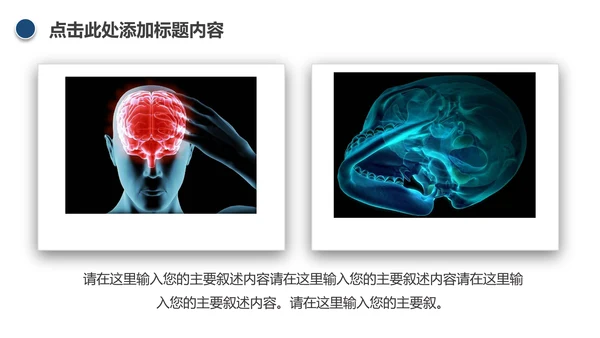 医学医疗大脑研究报告ppt动态模板