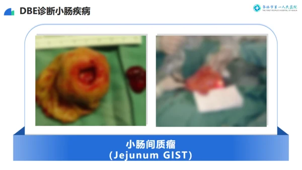 医院消化科专家交流指导莅临指导通用PPT模板
