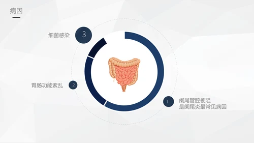 阑尾炎手术术后护理查房通用PPT模板