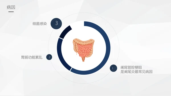 阑尾炎手术术后护理查房通用PPT模板