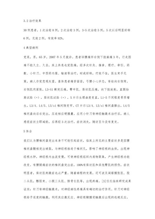 小针刀脊神经触激术治疗腰椎间盘突出症30例.docx