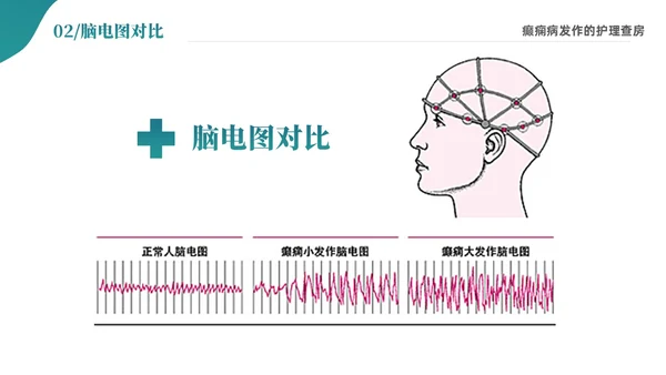 绿色清新简约癫痫病发作的护理查房ppt
