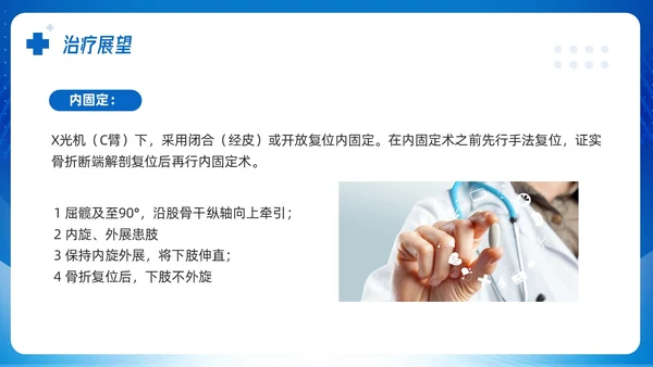 蓝色简约股骨颈骨折课件PPT模板宣传PPT动态PPT
