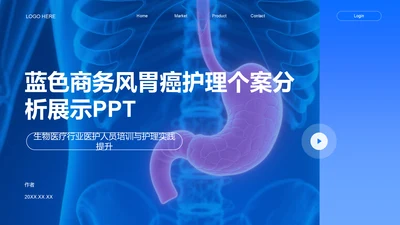 蓝色商务风胃癌护理个案分析展示PPT