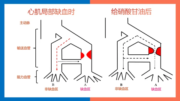 医院心内科药理学抗心绞痛PPT模板
