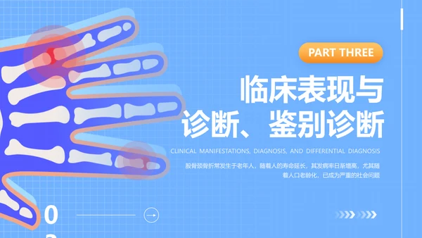 蓝色插画风股骨颈骨医护人员培训讲座医学护理PPT