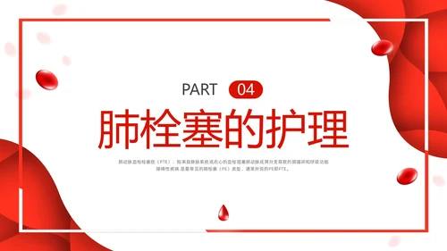 红色简约vte的预防及护理PPT模板宣传PPT动态PPT护理查房
