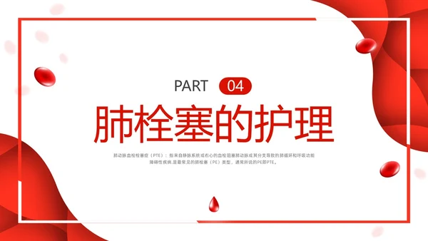 红色简约vte的预防及护理PPT模板宣传PPT动态PPT护理查房
