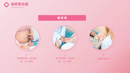 粉色实拍风异位妊娠的诊治医疗健康母婴孕妇培训PPT