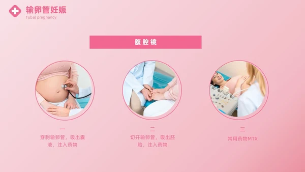粉色实拍风异位妊娠的诊治医疗健康母婴孕妇培训PPT