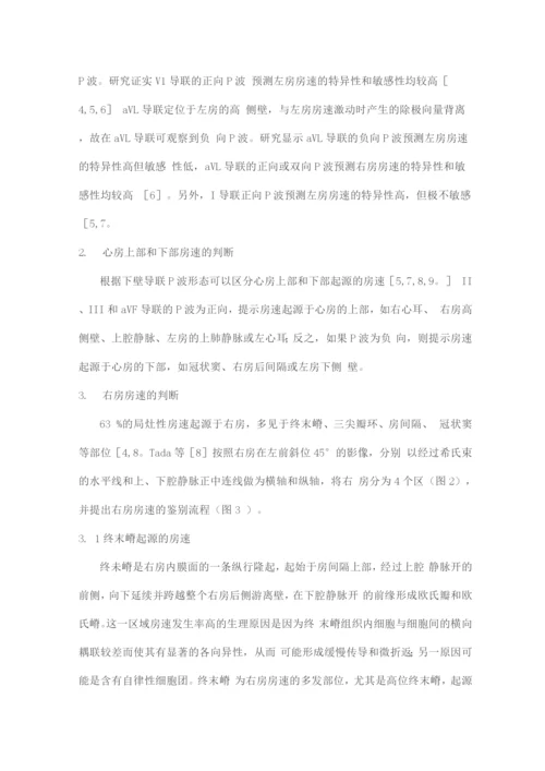 体表心电图快速判断房性心动过速起源的流程.docx