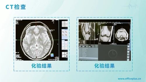 绿色渐变医学病例汇报PPT模板