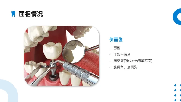 蓝色简约实拍口腔正畸病例讨论PPT课件