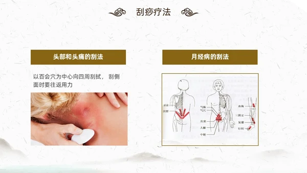 中国风古风中医妇科外治法传统中医文化经络护理培训PPT