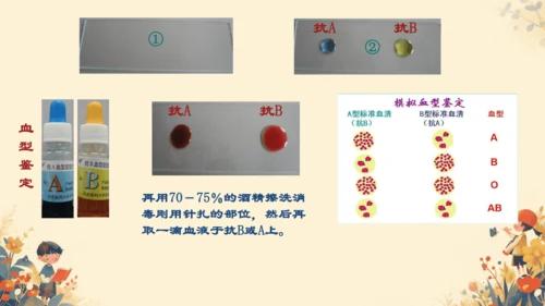 初中生物学人教版（新课程标准）七年级下册4. 4.4输血与血型课件(共21张PPT)