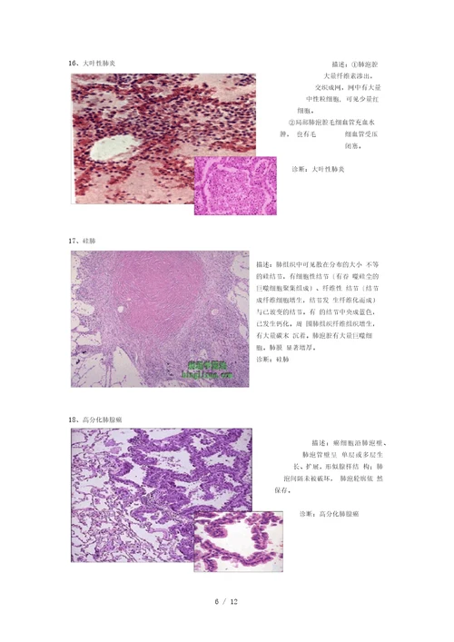 病理切片整理