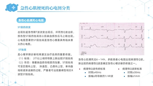 蓝色简约急性心肌梗死培训课件PPT模板