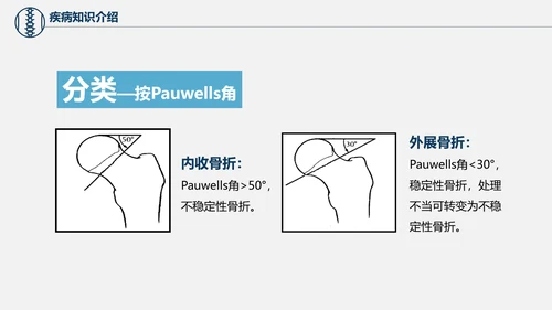 股骨颈骨折术后护理查房培训教学PPT课件