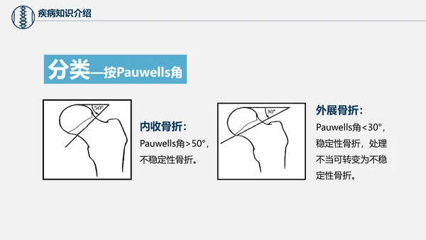 股骨颈骨折术后护理查房培训教学PPT课件