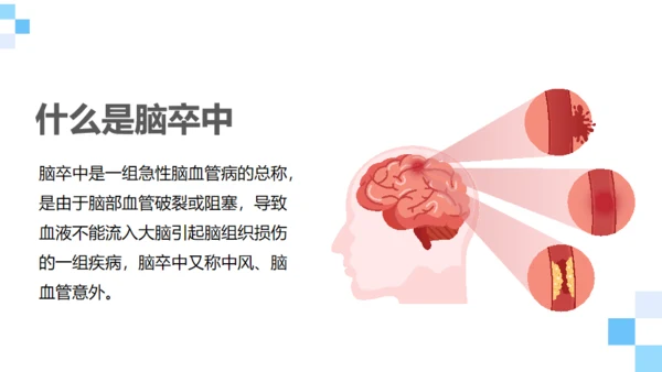脑卒中健康科普通用PPT模板