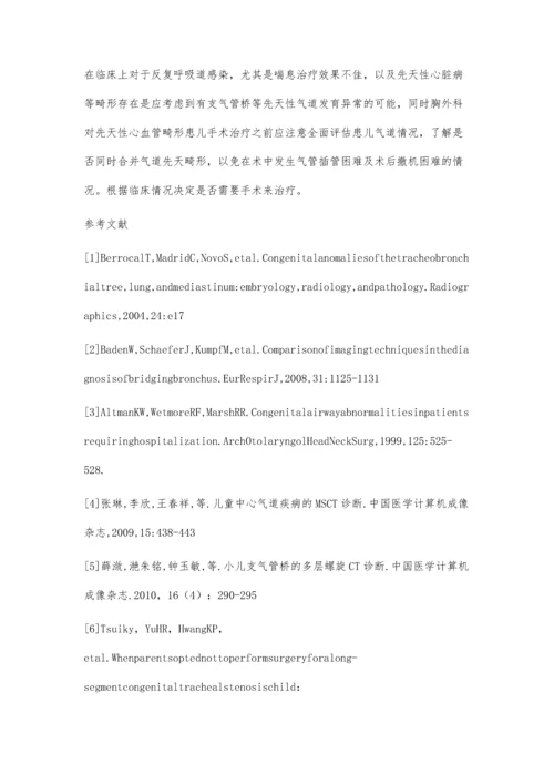 以反复喘息为表现的支气管桥畸形3例病例分析.docx