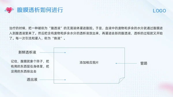 蓝色简约腹膜透析护理PPT模板宣传PPT动态PPT