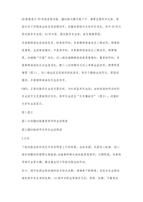 彩超诊断下肢动脉血栓形成所致血管狭窄.docx