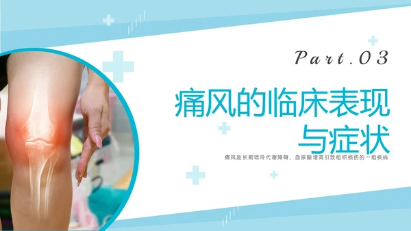 蓝色实拍商务风痛风性关节炎护理ppt