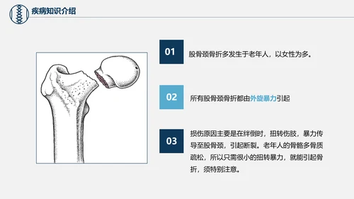 股骨颈骨折术后护理查房培训教学PPT课件