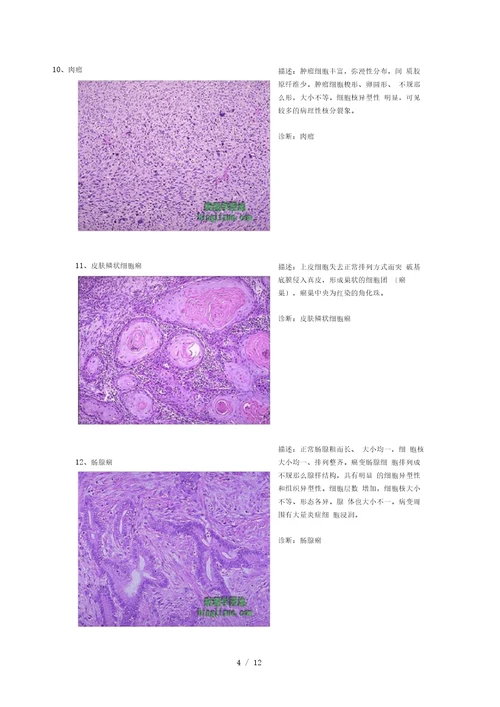 病理切片整理